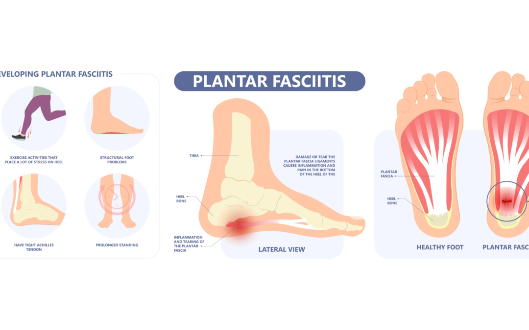 Why does the bottom of my foot hurt?