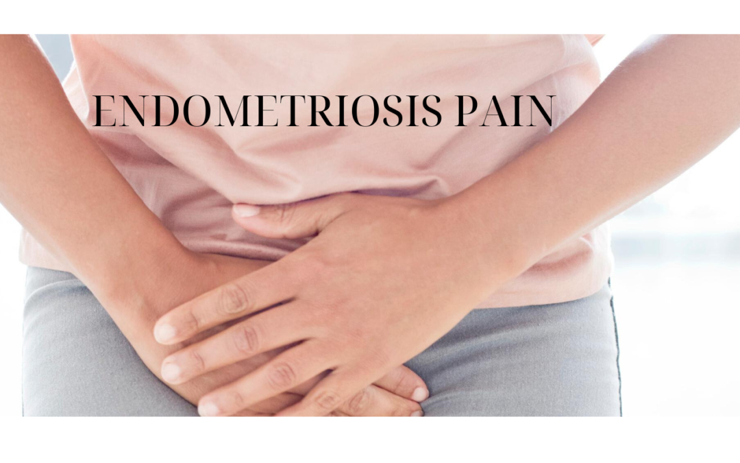 Treating Endometriosis Pain with Pelvic Physical Therapy