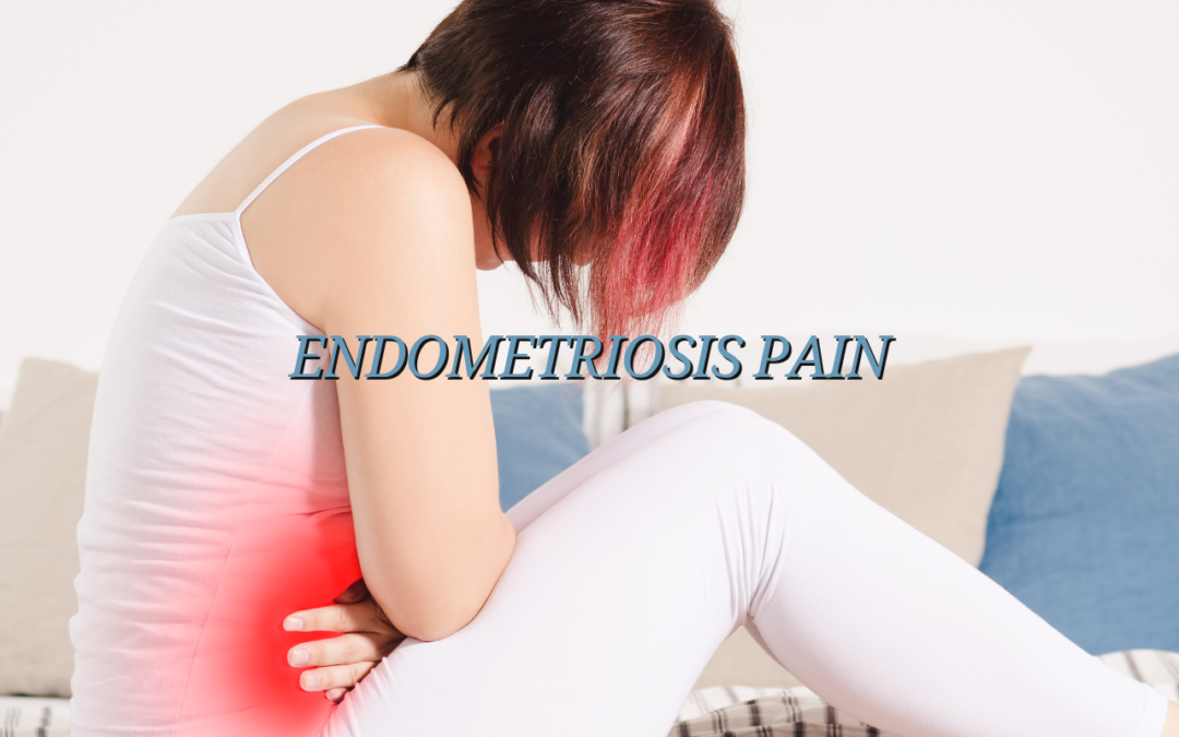 Pelvic Physical Therapy and Endometriosis