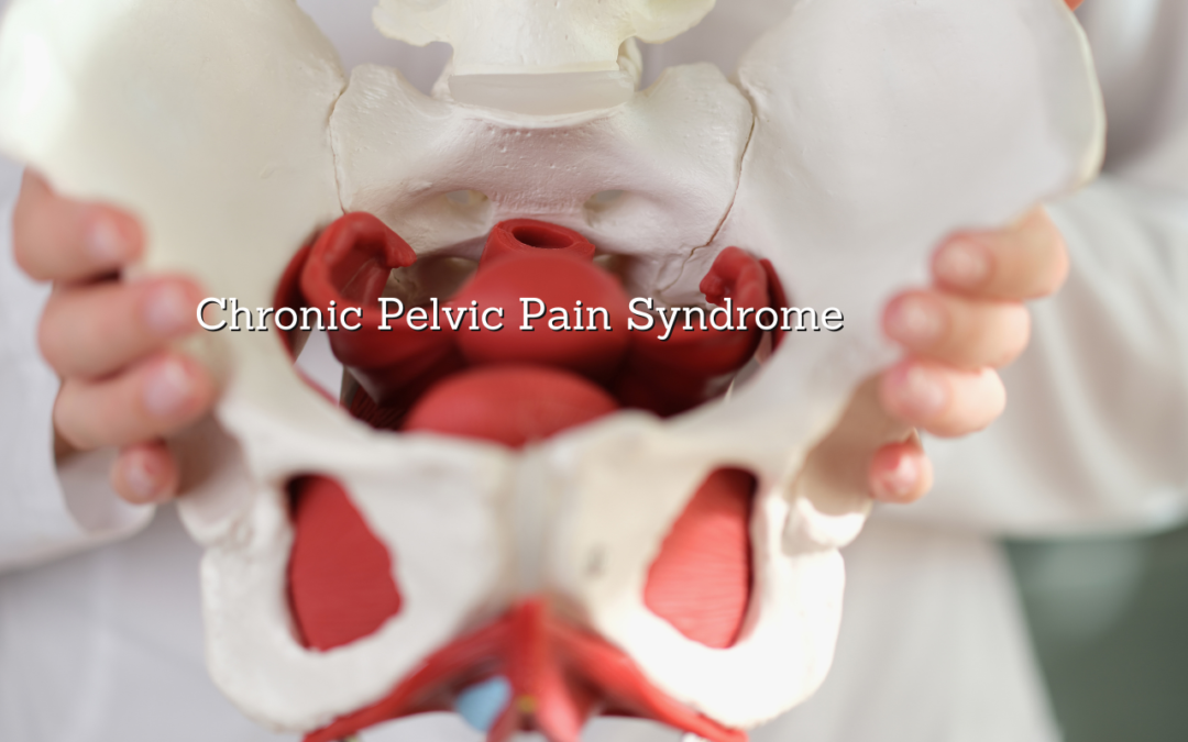 Understanding Chronic Pelvic Pain Syndrome: The Role of Pelvic Physical Therapy